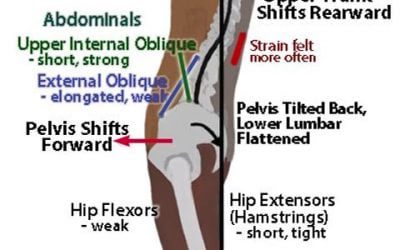 Development of Lower Back Pain